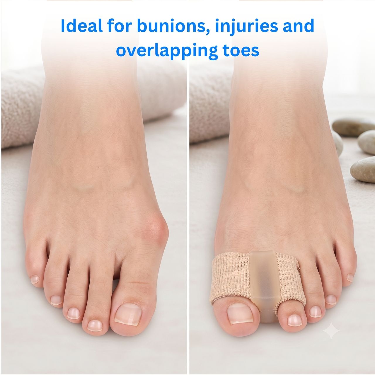 Ideal for bunions, injuries, and overlapping toes
