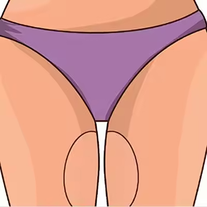 AntiChafing, self-adhesive protection to prevent chafing between the thighs (2 pieces) - Image 4