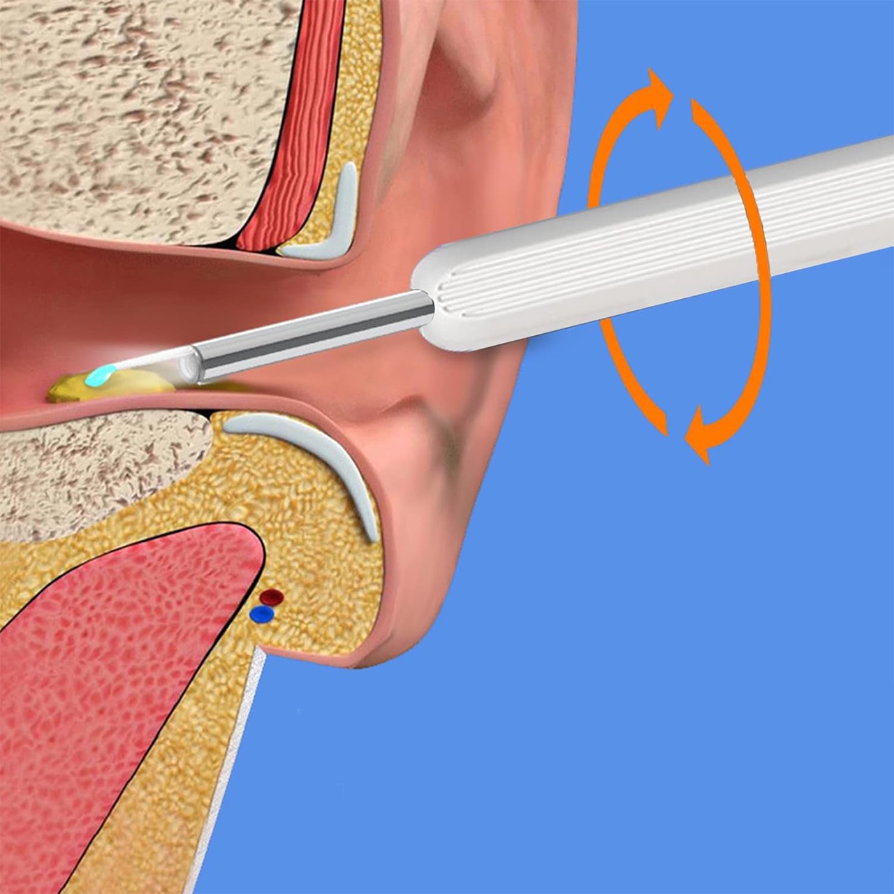 EarStick, the ear butter cleaning aid with camera - Image 2