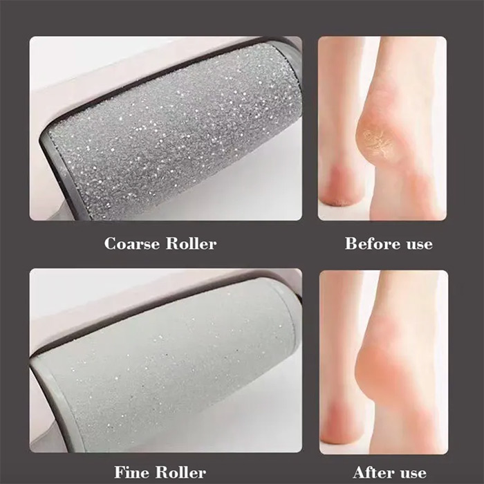 FeetBundle – electric foot roller + foot-care socks - Image 7